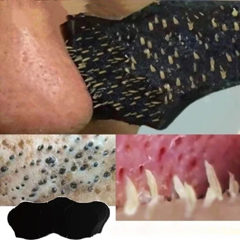 Charcoal Pore Strip - Unissex cravo remover máscara tiras nasais
