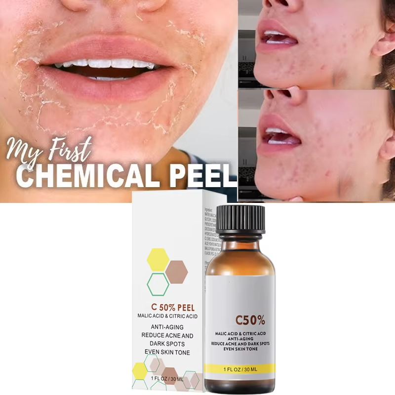 Salicylic Acid Cleanser - Com ácido málico e ácido cítrico