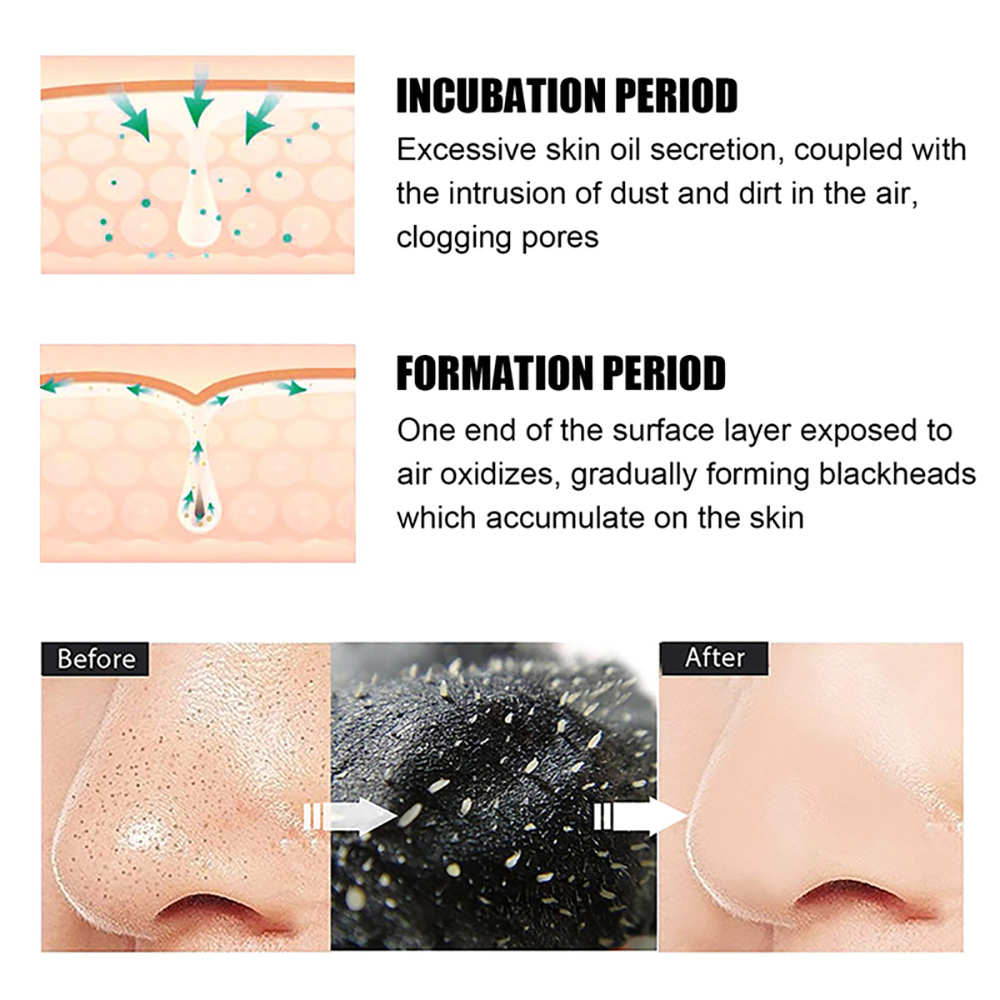 10/20/50/100 pçs nariz cravo r - Charcoal Pore Strip avaliação e preço