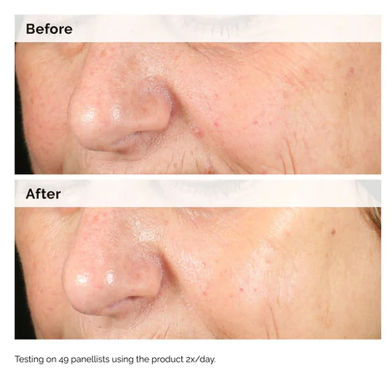 Alpha Arbutin 2% + HA 30ml Sor - Aha Bha Exfoliant avaliação e preço
