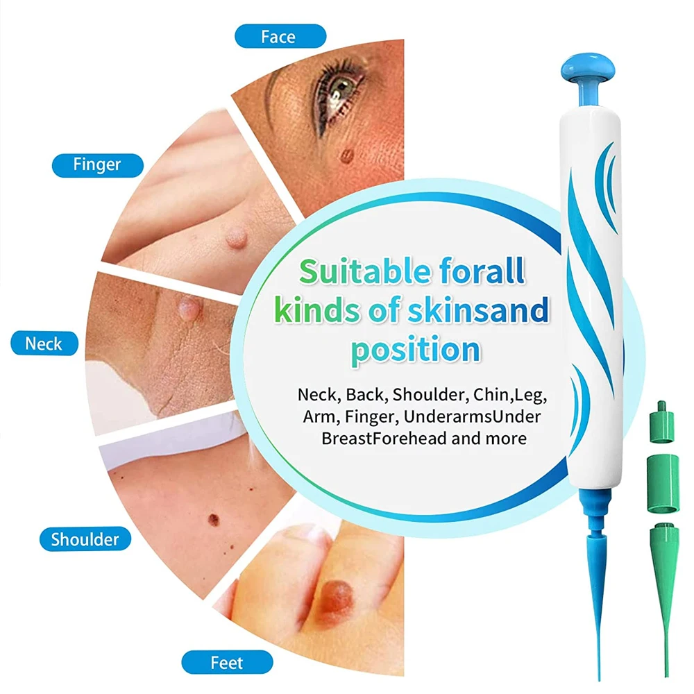 2 em 1 dispositivo removedor d - Skincare Ingredients Checker avaliação e preço