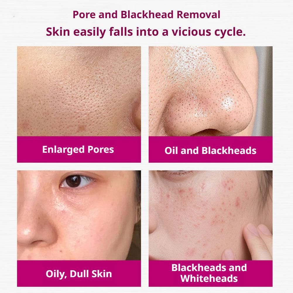 Sérum de Ácido Salicílico para - Aha Bha Exfoliant avaliação e preço