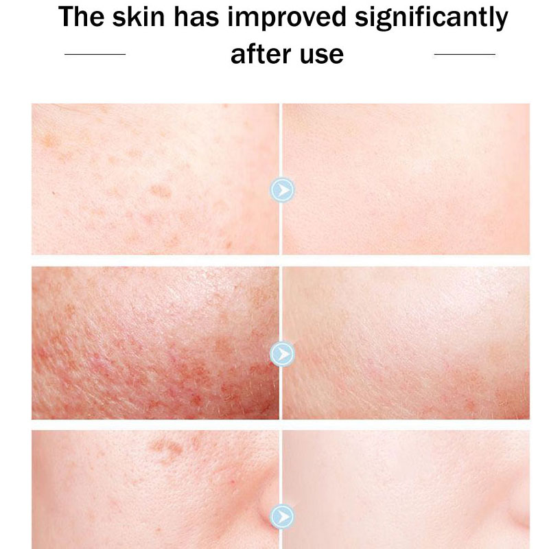 Marca rainha original creme de - Skincare Queen avaliação e preço