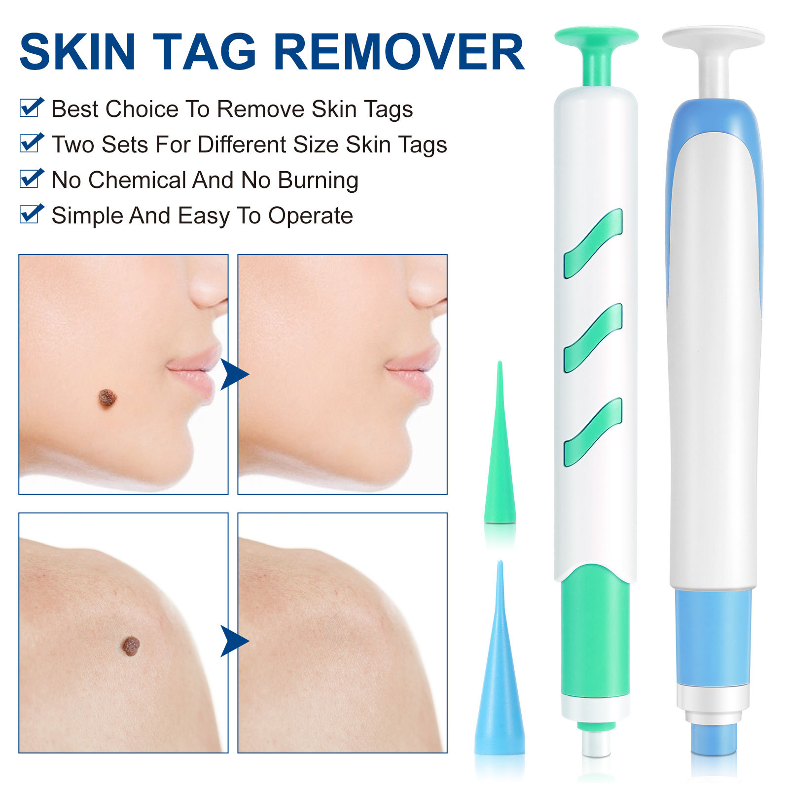 Kit de remoção automática de e - Skincare Ingredients Checker avaliação e preço